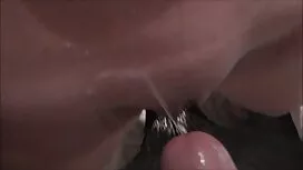 التنس الراديكالي احل ...